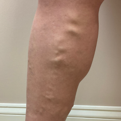 before_leg_1.png