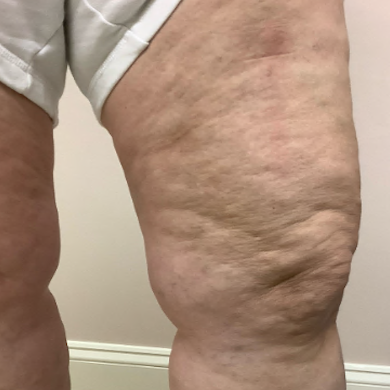 after_leg.png