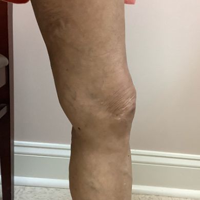 legs after 2.jpg