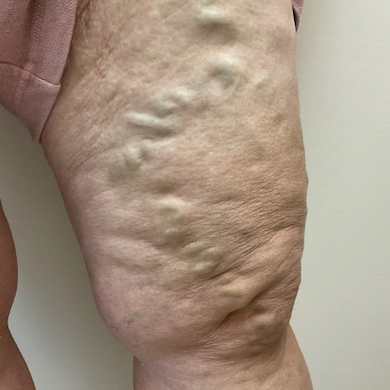 before_leg.png
