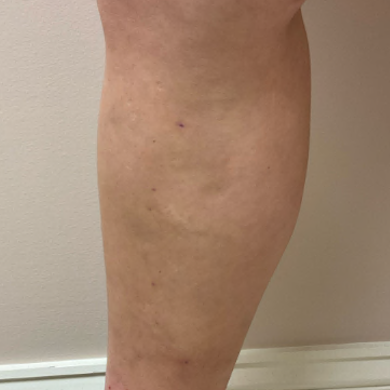 after_leg_1.png
