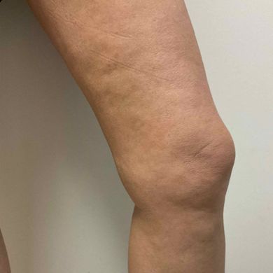 legs after.jpg