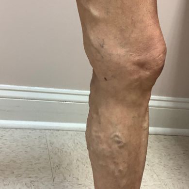 legs before 2.jpg
