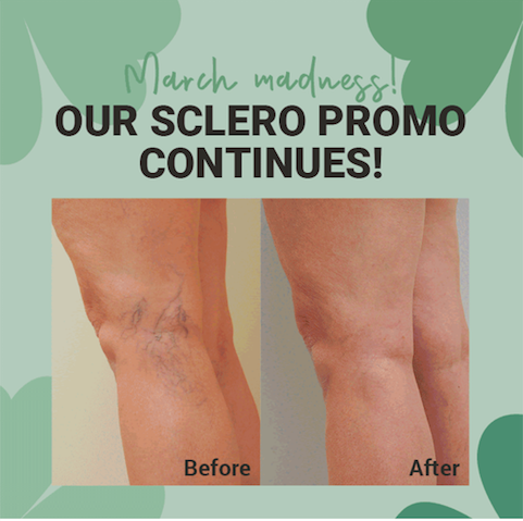 Sclero Promo